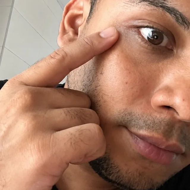 Cliente mostrando el resultado en el contorno de ojos con Instant Eye Fix